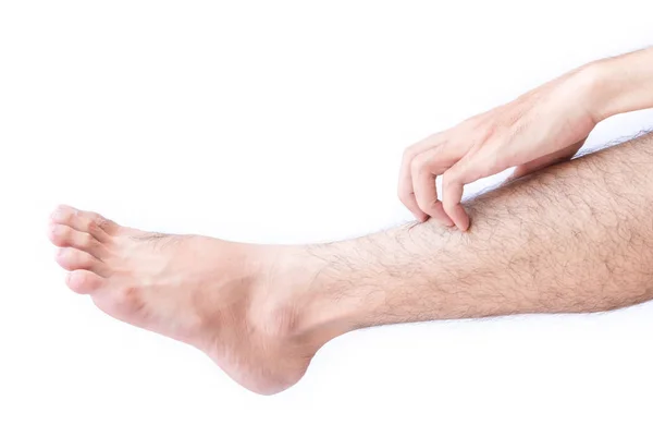 Mano de mujer arañando en los pies con fondo blanco para un concepto saludable — Foto de Stock