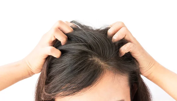 Primo piano donna mano prurito cuoio capelluto, concetto di cura dei capelli — Foto Stock