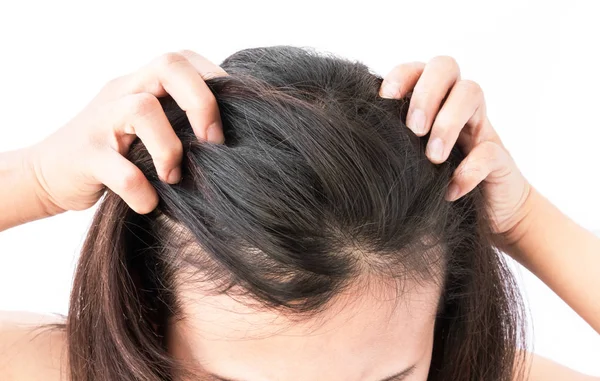 Closeup mulher mão coceira couro cabeludo, conceito de cuidados com o cabelo — Fotografia de Stock