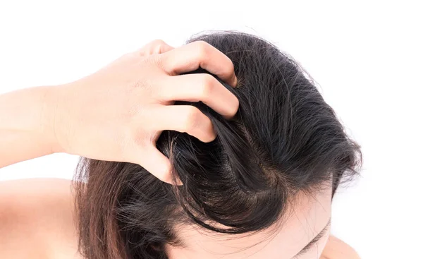 Closeup woman hand itchy scalp, Hair care concept — Stock Photo, Image