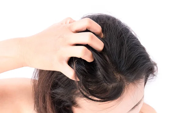 Closeup woman hand itchy scalp, Hair care concept Royalty Free Stock Images