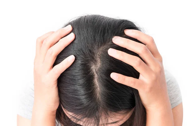 Primeros planos mujer mano picazón cuero cabelludo, concepto de cuidado del cabello —  Fotos de Stock