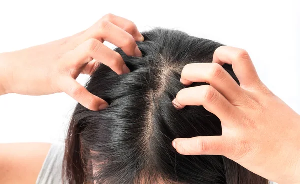 Vértes nő kéz viszkető fejbőr, haj ellátás fogalma — Stock Fotó