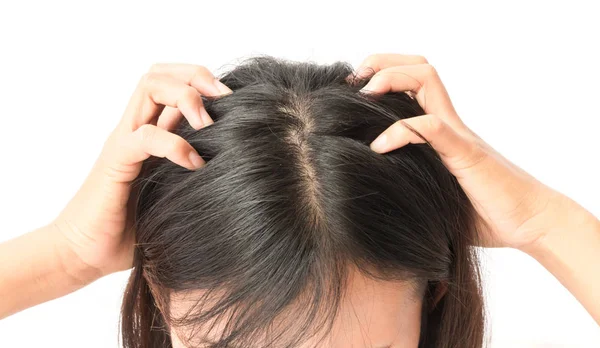 Closeup woman hand itchy scalp, Hair care concept — Stock Photo, Image