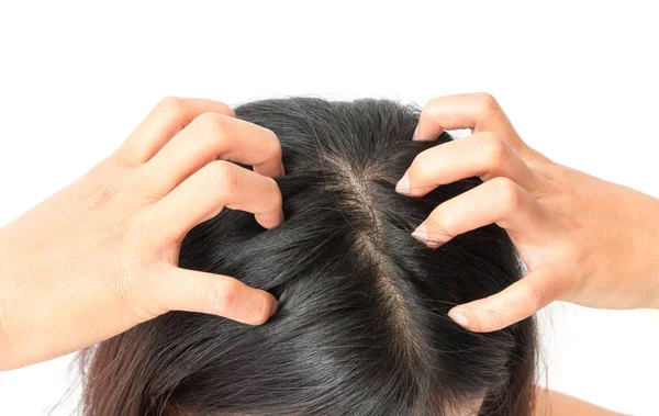 Primo piano donna mano prurito cuoio capelluto, concetto di cura dei capelli — Foto Stock