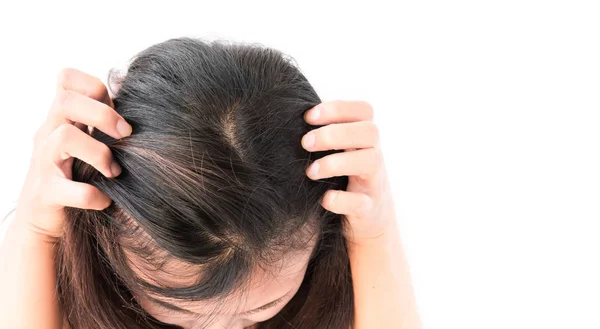 Wanita closeup tangan gatal kulit kepala, konsep perawatan rambut — Stok Foto