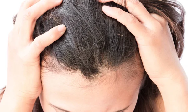 Primeros planos mujer mano picazón cuero cabelludo, concepto de cuidado del cabello —  Fotos de Stock