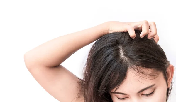 Primeros planos mujer mano picazón cuero cabelludo, concepto de cuidado del cabello — Foto de Stock