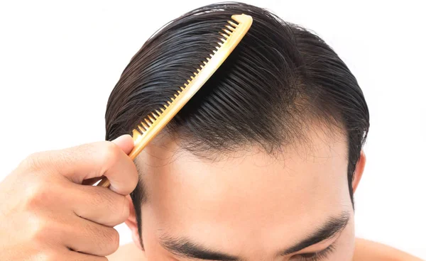 Молодий чоловік турбується про проблеми випадіння волосся для шампуню охорони здоров'я і бути — стокове фото