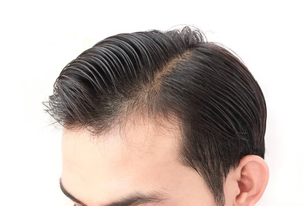 Молодой человек беспокоиться проблемы выпадения волос для здравоохранения шампунь и концепция косметического продукта — стоковое фото