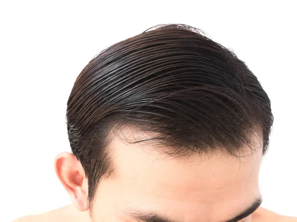 Joven hombre preocupado problema de pérdida de cabello para el cuidado de la salud champú y concepto de producto de belleza — Foto de Stock