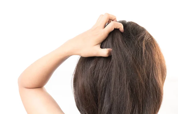 Närbild kvinna hand kliande hårbotten, hår vård koncept — Stockfoto