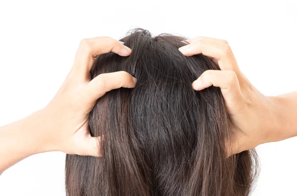 Closeup woman hand itchy scalp, Hair care concept — Stock Photo, Image