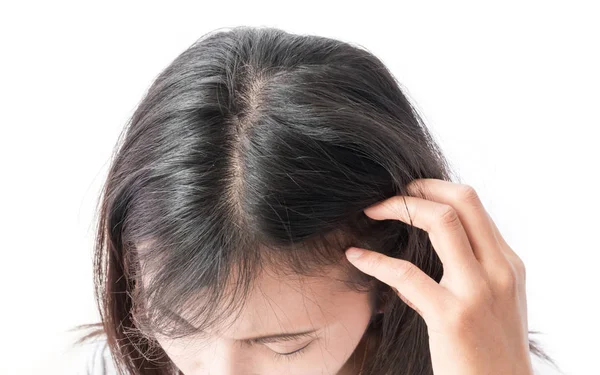 Closeup woman hand itchy scalp, Hair care concept — Stock Photo, Image