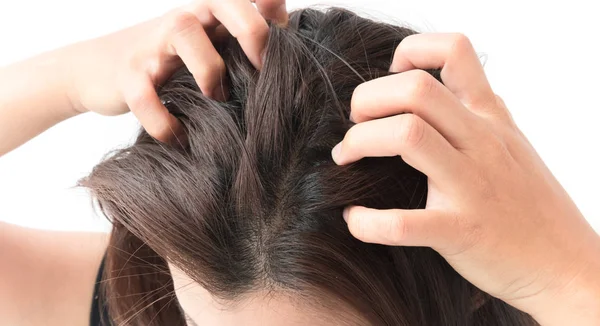 Primeros planos mujer mano picazón cuero cabelludo, concepto de cuidado del cabello —  Fotos de Stock