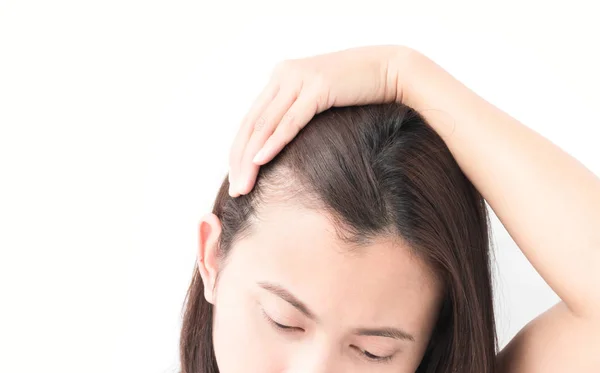 Wanita serius kehilangan rambut masalah untuk kesehatan sampo dan konsep produk kecantikan — Stok Foto