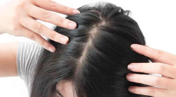 Mujer grave problema de pérdida de cabello para el cuidado de la salud champú y concepto de producto de belleza —  Fotos de Stock