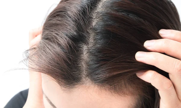 Wanita serius kehilangan rambut masalah untuk kesehatan sampo dan konsep produk kecantikan — Stok Foto