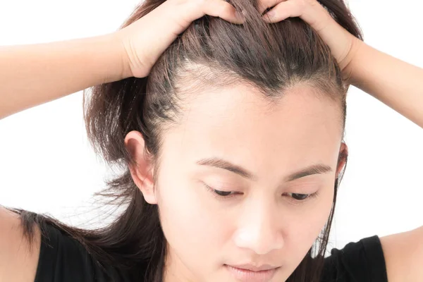 Mujer grave problema de pérdida de cabello para el cuidado de la salud champú y concepto de producto de belleza —  Fotos de Stock