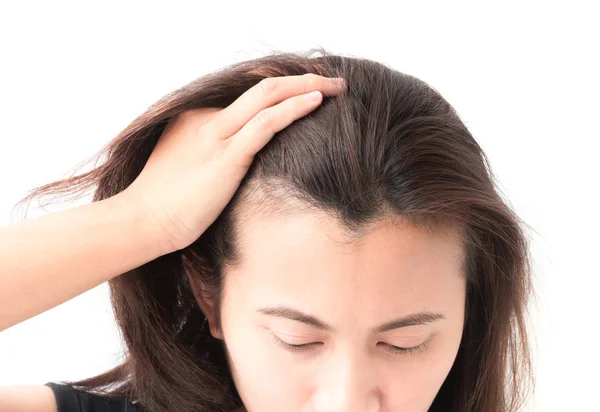 Donna grave problema di perdita dei capelli per shampoo sanitario e beau — Foto Stock