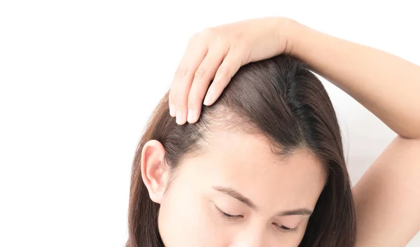 Mulher grave problema de perda de cabelo para shampoo cuidados de saúde e beau — Fotografia de Stock