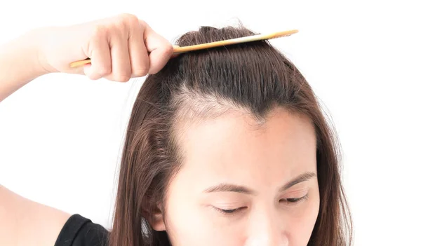 Mulher grave problema de perda de cabelo para shampoo cuidados de saúde e beau — Fotografia de Stock