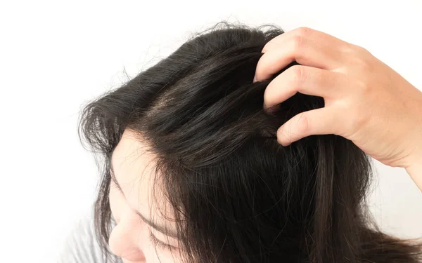 Крупним планом жінка рука свербить шкіру голови, концепція догляду за волоссям — стокове фото