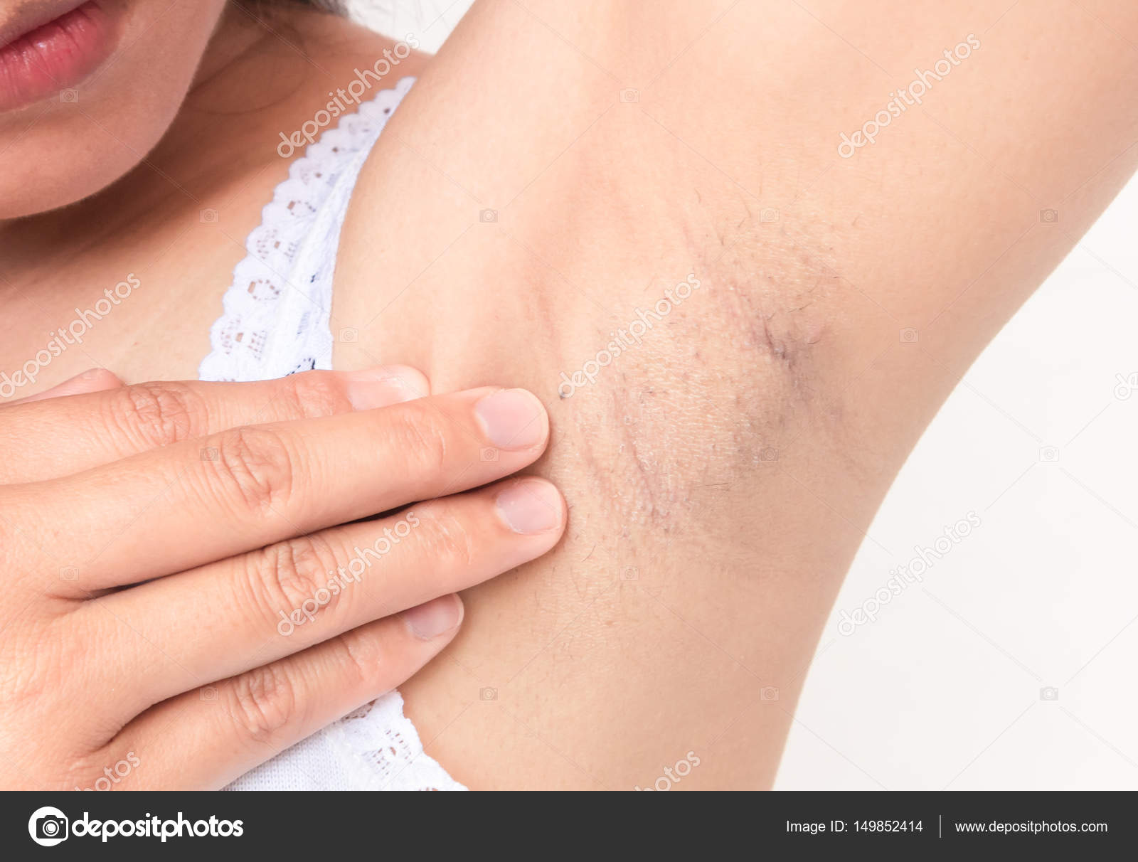 компресс под мышкой