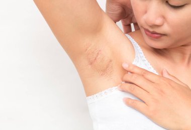 Kadınlar sorun siyah koltukaltı cilt bakım ve güzellik kavramı için