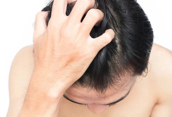 Primer plano hombre mano picazón cuero cabelludo, concepto de cuidado del cabello — Foto de Stock