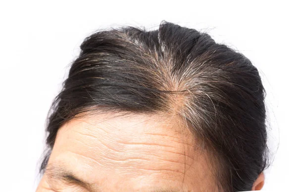 Closeup wrinkles on forehead and grey hair old woman, health car Stock Picture