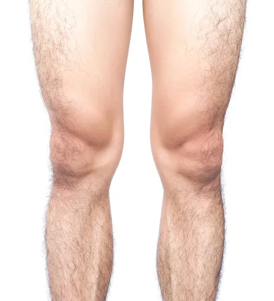 Closeup legs men skin and hairy with white background, health ca — Stock Photo, Image