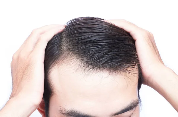 Молодой человек серьезная проблема выпадения волос для здравоохранения медицинской концепции и шампуня продукт — стоковое фото