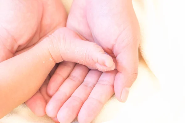 Closeup legs of newborn with peeling skin on mother hands, health care and medical concept — Stock Photo, Image
