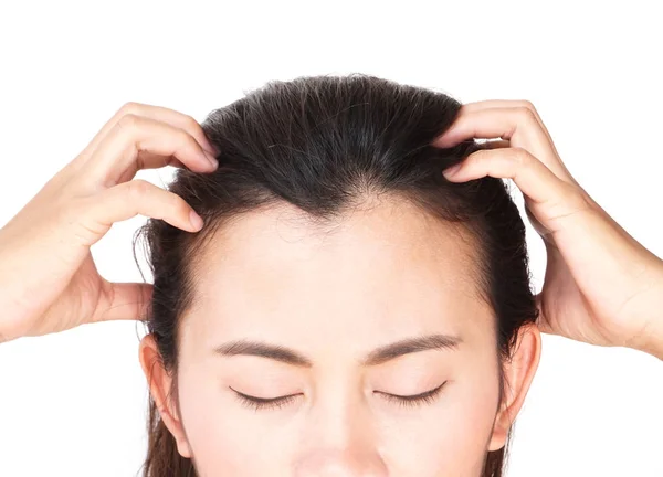 Mujer grave problema de pérdida de cabello para el cuidado de la salud champú y concepto de producto de belleza —  Fotos de Stock