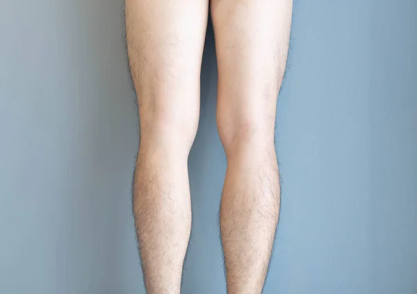 Primer plano de la parte posterior de las piernas de los hombres de piel y peludo para el concepto de atención de la salud con fondo gris — Foto de Stock