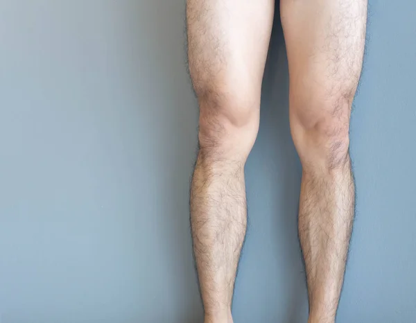 Zbliżenie nogi mężczyźni skóra i owłosione dla opieki zdrowotnej koncepcja z szarym tle — Zdjęcie stockowe