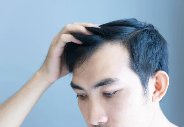 Joven hombre serio problema de pérdida de cabello para el cuidado de la salud médico y champú concepto de producto, enfoque selectivo — Foto de Stock