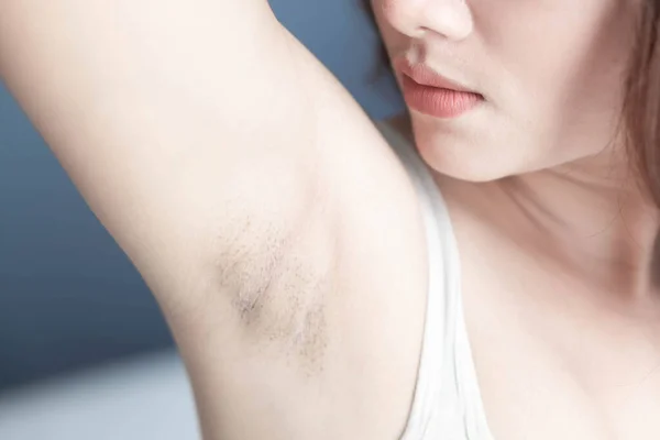Dameproblem Svart armhule med grå bakgrunn for hudpleie og skjønnhetskonsept, selektivt fokus – stockfoto