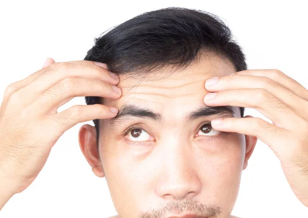 Closeup Man Showing Wrinkles Forehead — Stock Photo, Image