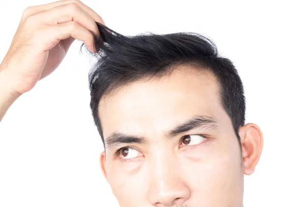 Young Man Serious Hair Loss Problem Health Care Medical Shampoo — Stock Photo, Image