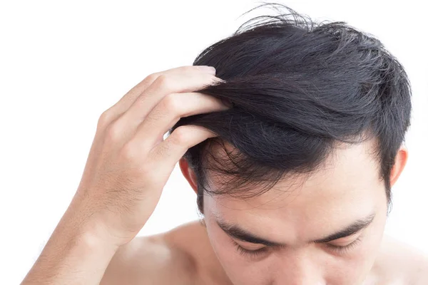 Young Man Serious Hair Loss Problem Health Care Medical Shampoo — Stock Photo, Image
