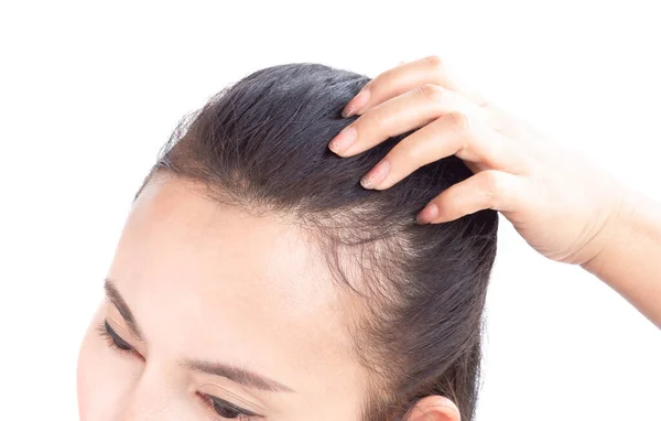 Жінка Серйозна Проблема Випадіння Волосся Охорони Здоров Шампунь Концепція Косметичного — стокове фото