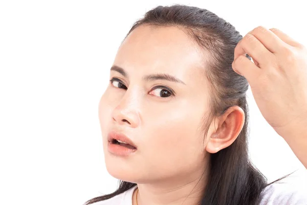 Close Mão Mulher Segurando Problema Perda Cabelo Para Shampoo Cuidados — Fotografia de Stock