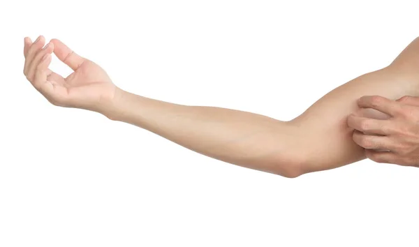 Nahaufnahme Mann Hand Kratzt Allergie Hautausschlag Arm Haut Mit Weißem — Stockfoto