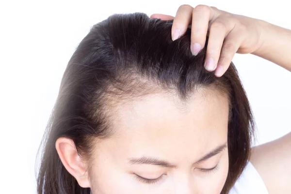 Mulher Grave Problema Perda Cabelo Para Shampoo Cuidados Saúde Conceito — Fotografia de Stock