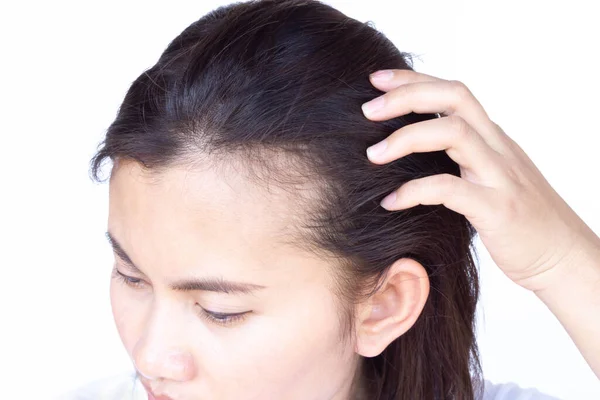 Mulher Grave Problema Perda Cabelo Para Shampoo Cuidados Saúde Conceito — Fotografia de Stock