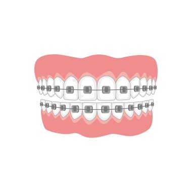  Dişler beyaz arka plan üzerinde diş teli ile. 