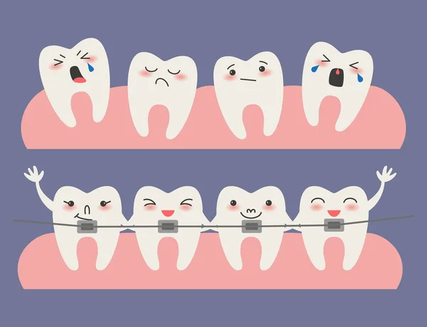 Cartoon Teeth with braces on blue background. — Stock Vector