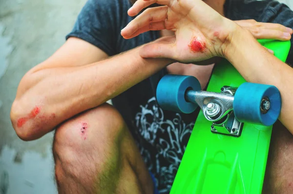 Injuries in extreme sports — Stock Photo, Image